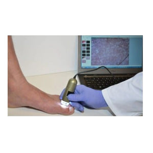 Medical Microscope - 1.3 MP Podoscope - Dino-Lite Dino-Lite 