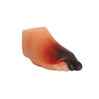 Severe diabetic foot model - Anatomy and pathology