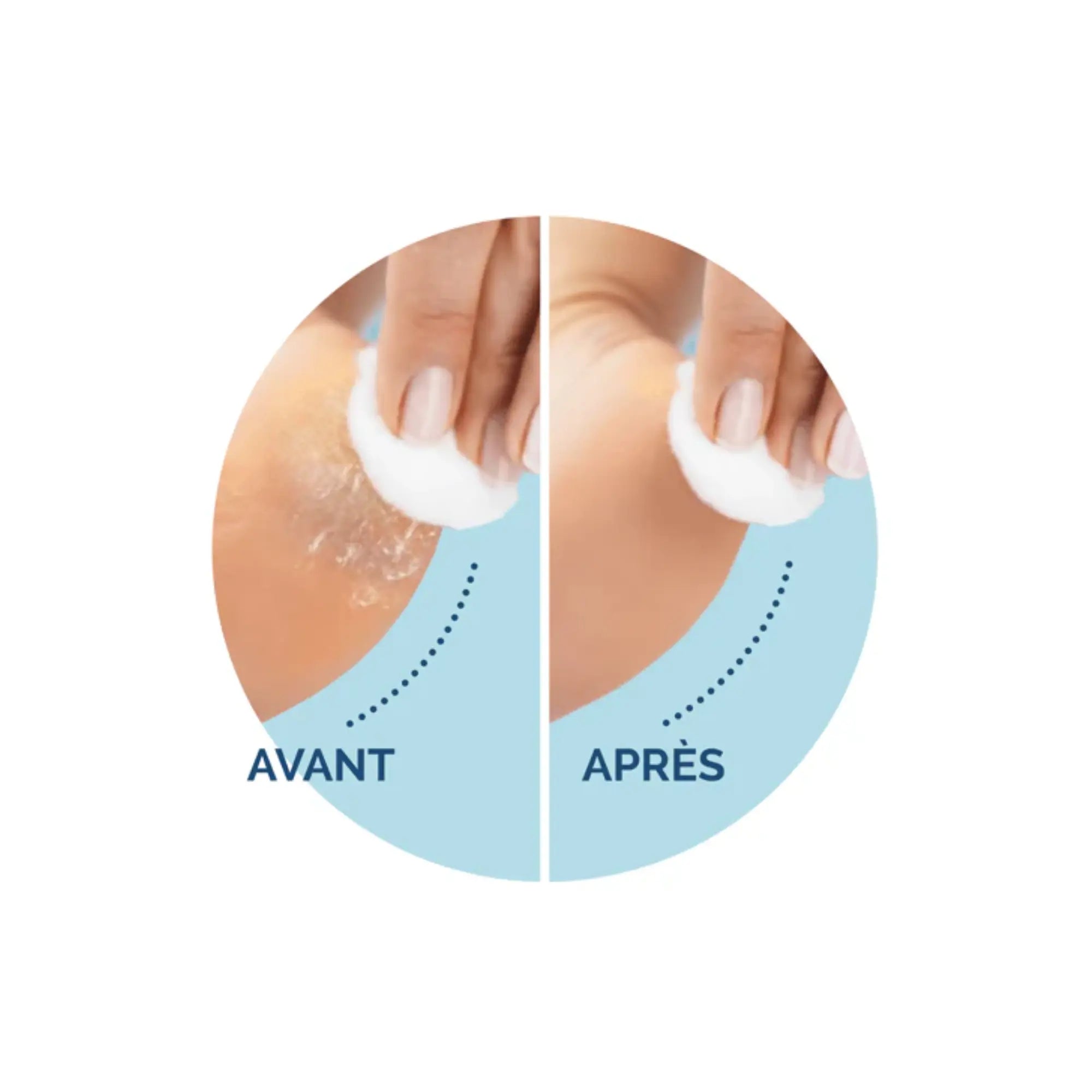 Recharge Rouleau Grain Ultra-Exfoliant - Râpe de Pédicurie Électrique - Velvet Smooth - Scholl Scholl 