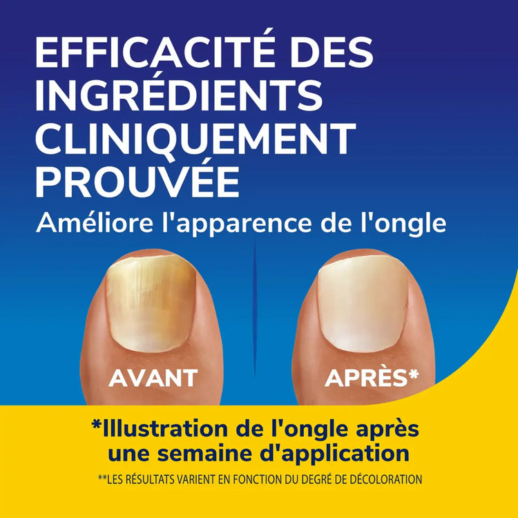 Sérum Revitalisant Ongles Jaunis, Décolorés, Abîmés - 10 ml - Dr Scholl’s Scholl 