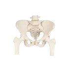 Pelvic skeleton, female, with femur stumps - Anatomy and pathology